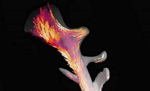 Researchers Reveal 3-D Nanostructure of a Bone